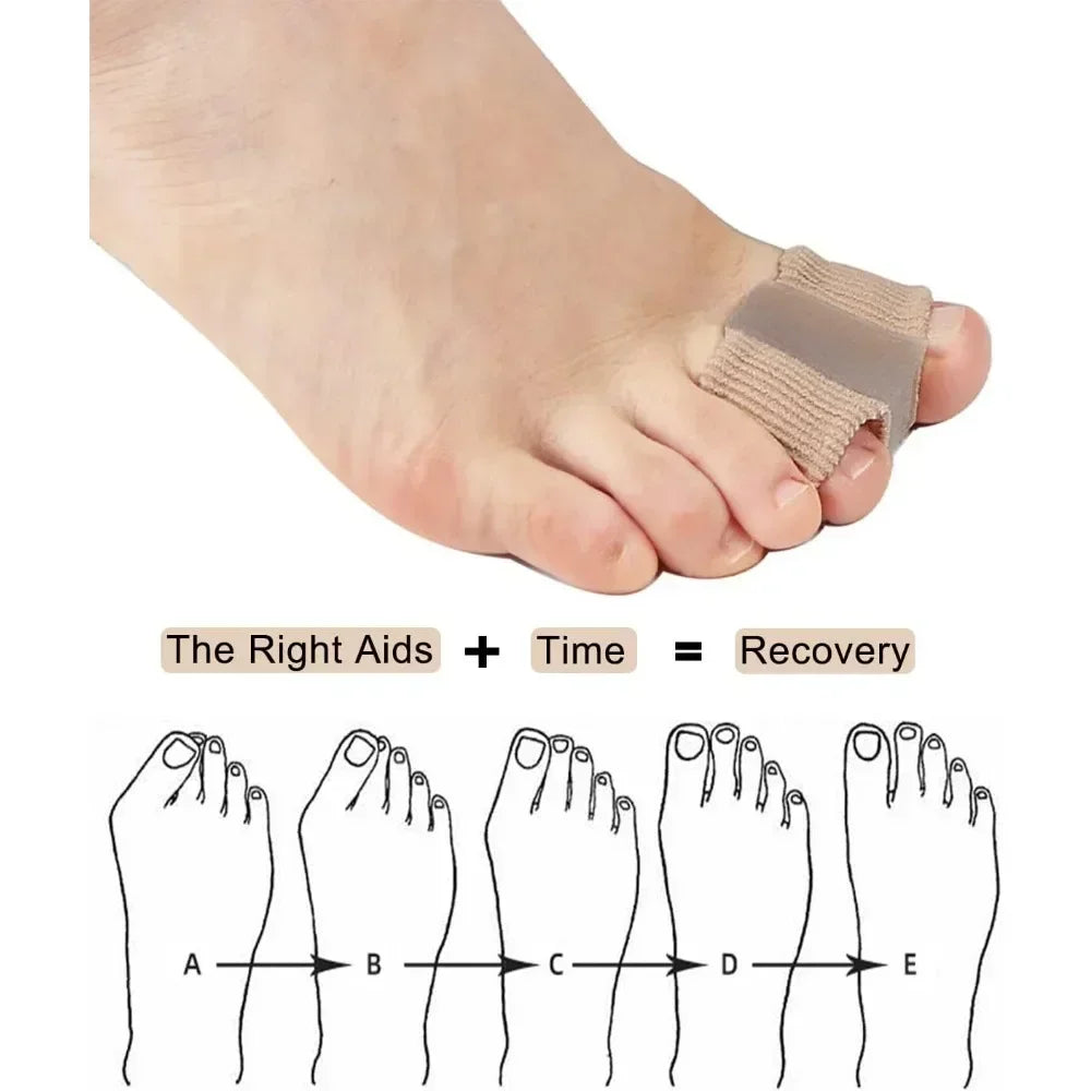 Hallux Valgus Gel Toe Separator Pads Set