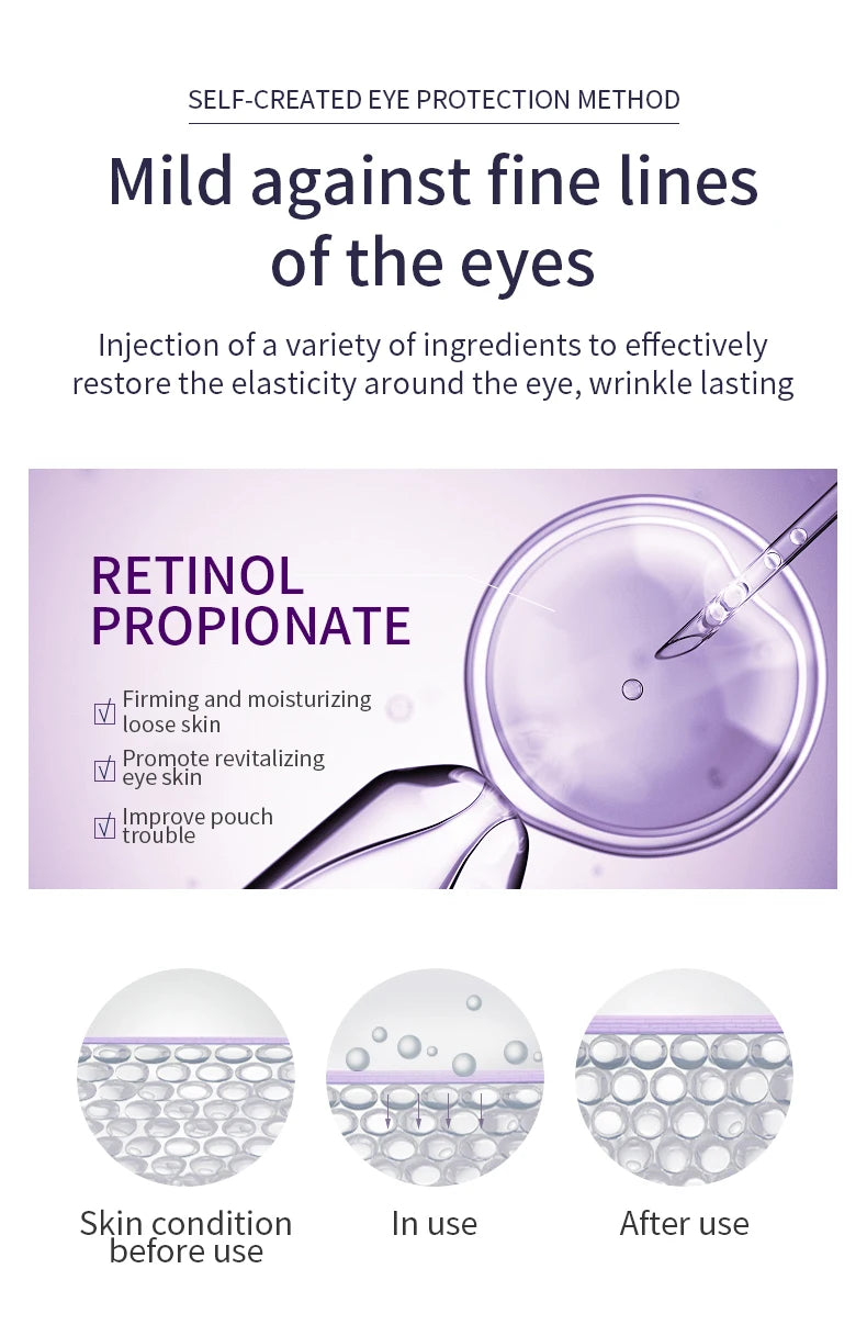 Anti Wrinkle Eye Cream Roller Massager Pro reduces dark circles, hydrates deeply, smooths fine lines, and refreshes tired eyes for a youthful look
