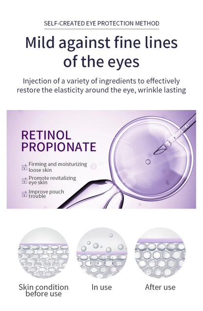 Anti Wrinkle Eye Cream Roller Massager Pro reduces dark circles, hydrates deeply, smooths fine lines, and refreshes tired eyes for a youthful look