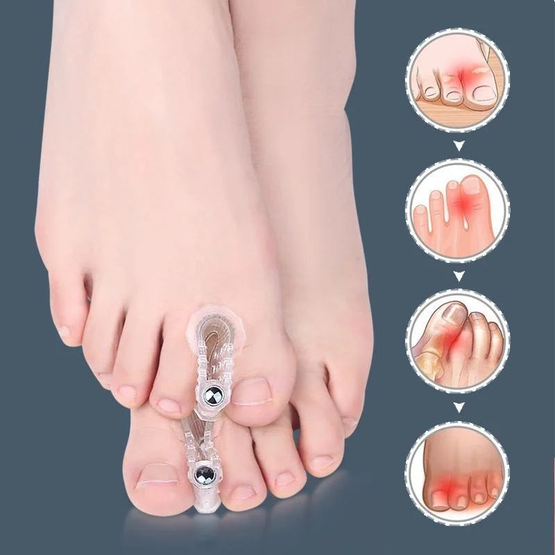 Bunion Toe Corrector 2pcs Foot SupportX2