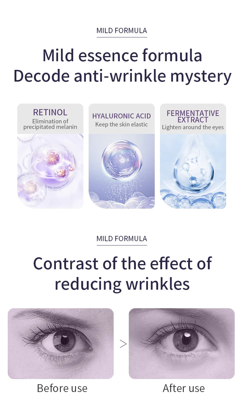 Anti Wrinkle Eye Cream Roller Massager Pro reduces dark circles, hydrates deeply, smooths fine lines, and refreshes tired eyes for a youthful look
